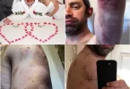 Man reveals years of abuse suffered in marriage, including using makeup to conceal bruises inflicted by his wife.